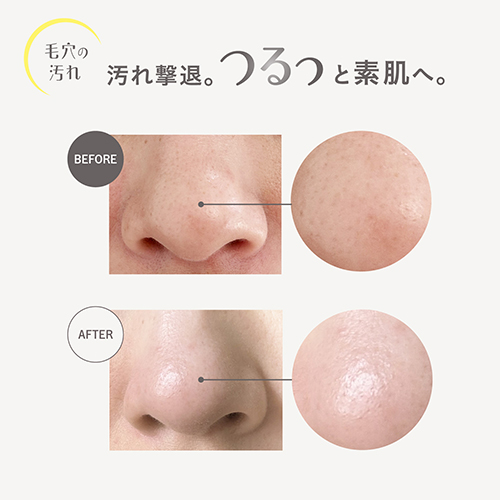 カプセルセラム（capsule serum） クレンジングオイル V 150mL