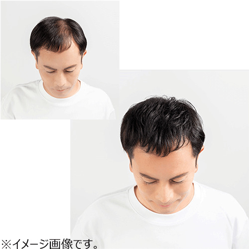 ルアン（RUAN） スーパーミリオンヘアー コンパクトセット No.1