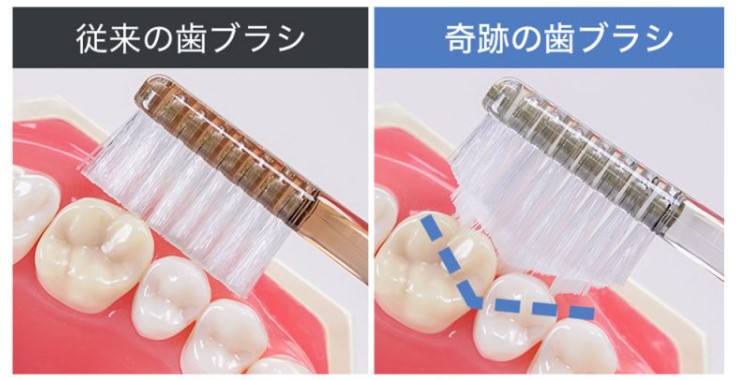 正規品◎奇跡のハブラシ　選べる16本 71A6QyNcE2L._UF894,1000_QL80_.jpg